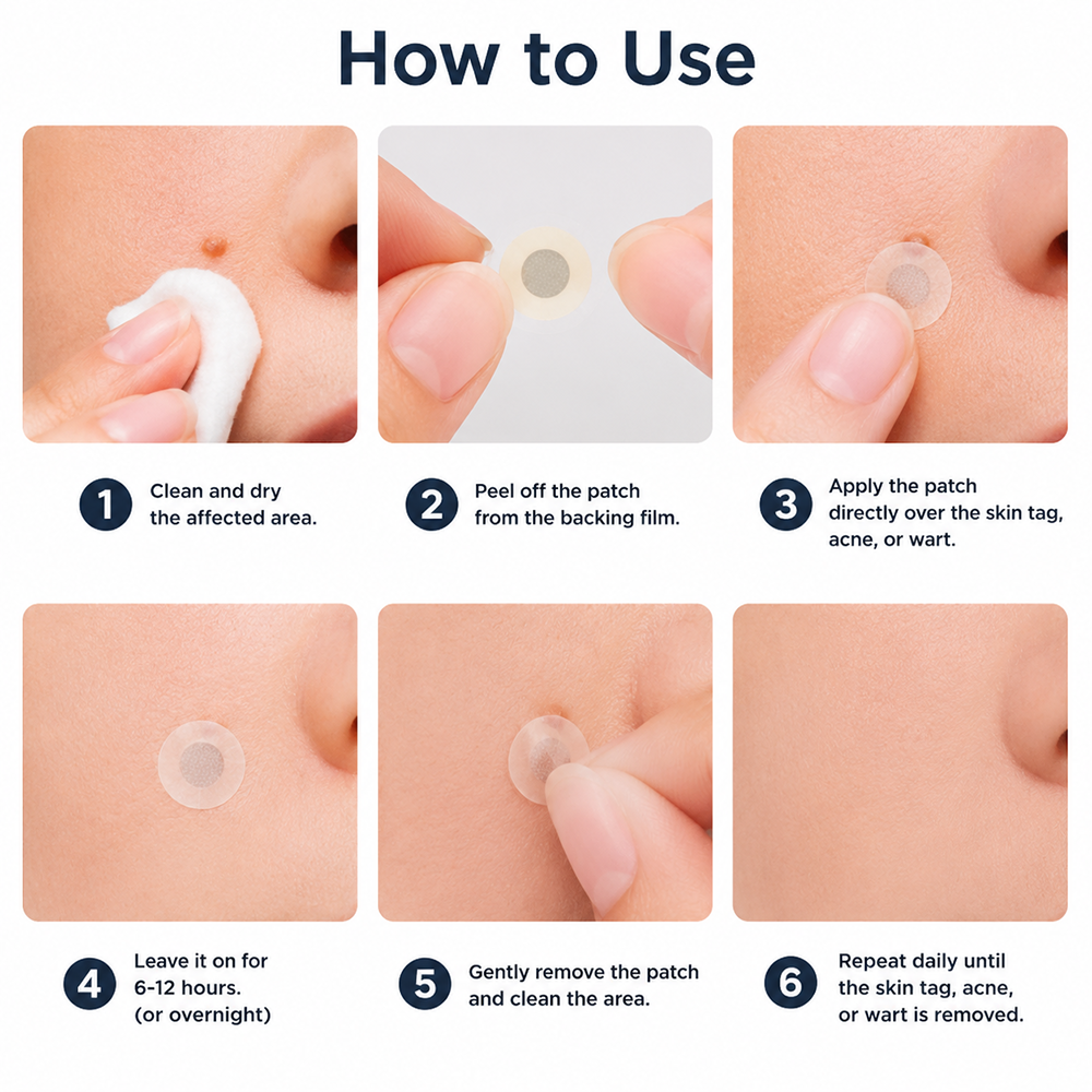 Hiskin ® 2-in-1 Microneedle & Hydrocolloid Patch | Removes raised moles, acne, flat warts, and skin tags | Helps improve wrinkles, scars, and blemishes | Invisible patches for face and body