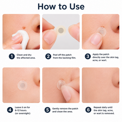 Hiskin ® 2-in-1 Microneedle & Hydrocolloid Patch | Removes raised moles, acne, flat warts, and skin tags | Helps improve wrinkles, scars, and blemishes | Invisible patches for face and body