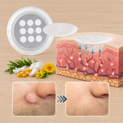 Hiskin ® 2-in-1 Microneedle & Hydrocolloid Patch | Removes raised moles, acne, flat warts, and skin tags | Helps improve wrinkles, scars, and blemishes | Invisible patches for face and body